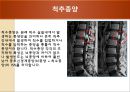 [물리치료] 척추에 대한 질환 16페이지