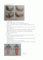 척수손상 대상자 건강사정 및 간호진단 보고서 4페이지