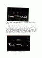 [번역본] 전안부(前眼部) OCT 및 유수정체 안내(眼內) 렌즈: 앞으로의 전망 (Anterior segment OCT and phakic intraocular lenses: A perspective) 11페이지
