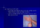 [의학] 수근관 증후군 (carpal tunnel syndrome) PPT자료 15페이지