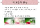 [의학간호학기초] 시각장애  - 녹내장 18페이지
