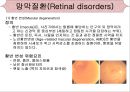 [의학간호학기초] 시각장애  - 녹내장 22페이지