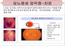 [의학간호학기초] 시각장애  - 녹내장 26페이지