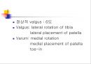 [질환별 물리치료] 관절기형 (Disorder of bone and joint).ppt 15페이지
