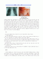 [질환별 물리치료] 만성폐쇄성 폐질환(COPD)에 관해 8페이지