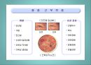 [질환별 물리치료] 중증근무력증 (Myasthenia Gravis).ppt 5페이지