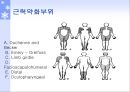 [질환별 물리치료] PMD[Progressive Muscular Dystrophy] 13페이지