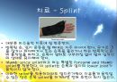 [질환별 물리치료] 드퀘르벵 디지즈[De Quervain\'s Tenosynovitis] 9페이지