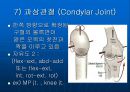 [해부생리학] 윤활관절의 역학적 구조 13페이지