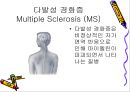 질환별 물리치료 - 파킨슨, 다발성경화증에 물리치료 13페이지