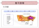 [의학간호기초] 청각장애.ppt 2페이지