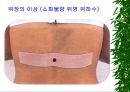 [물리치료] 밸런스 테이핑 요법에 관해 34페이지