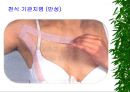 [물리치료] 밸런스 테이핑 요법에 관해 41페이지