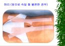 [물리치료] 밸런스 테이핑 요법에 관해 45페이지