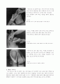 [물리치료] 증상별 테이프 요법 7페이지