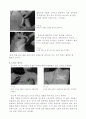 [물리치료] 증상별 테이프 요법 8페이지