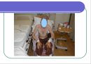[심폐물리치료] 폐 기능의 검사 20페이지