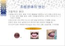 [언어치료] 조음 및 음운 장애 3페이지