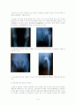 [의학] 고관절 전치술, 슬관절 전치술 -THR [Total Hip Replacement], TKR[Total Knee Replacement] 3페이지