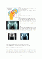 [의학] 고관절 전치술, 슬관절 전치술 -THR [Total Hip Replacement], TKR[Total Knee Replacement] 6페이지