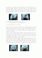 [의학] 고관절 전치술, 슬관절 전치술 -THR [Total Hip Replacement], TKR[Total Knee Replacement] 7페이지