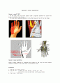 [의학] 기용 관 증후군[Guyon\'s canal syndrome]에 관해 1페이지
