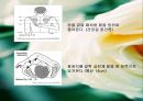 [의학] 오십견[frozen shoulder]에 관해 11페이지