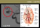 뇌졸중 전반조사 (해부/병태생리/약물/치료개발동향).ppt 7페이지