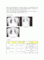 ICH(뇌출혈) A+케이스스터디 12페이지