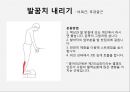 하지정맥류 varicose vein 원인 증상 및 예방  15페이지