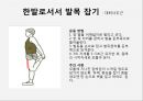 하지정맥류 varicose vein 원인 증상 및 예방  17페이지