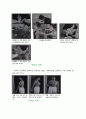 어깨충돌 증후군  7페이지