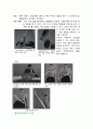 어깨충돌 증후군  9페이지