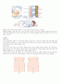 다양한 분만법 5페이지