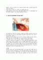 소화기계 내시경 - 내시경검사(endoscopy) 10페이지