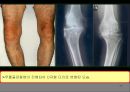 관절염 17페이지