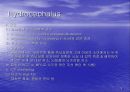 Hydrocephalus(수두증)(ppt) 9페이지