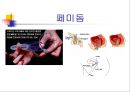 피임  24페이지