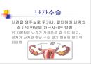 피임  26페이지