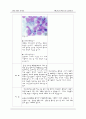 [간호학과] 소아과(PED,PICU) AML(acute myeloid leukemia/급성 골수성 백혈병)환아 케이스 스터디 (case study) 6페이지