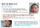 [아동간호학]여드름 5페이지
