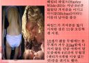 섭식장애 (섭식장애란, 섭식장애원인, 식장애치료, 섭식장애사례, 신경성식욕부진증, 거식증, 신경성폭식증).PPT자료 10페이지