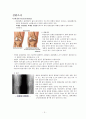 [간호학 실습 케이스] TKR (Total Knee Replacement) 인공 슬관절 전치환술 케이스 [인공관절치환술] (진단명 : Both. Knee OA(Osteoarthritis)) 5페이지