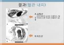 피부 노화 13페이지
