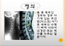 목 디스크(추간판 탈출증) 3페이지