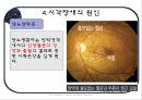 시각장애인의 심리  20페이지