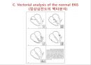  심전도 25페이지