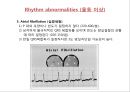 [Dankook Sports Medicine] 07. Abnormalities of the EKG.ppt 11페이지