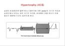 [Dankook Sports Medicine] 07. Abnormalities of the EKG.ppt 20페이지