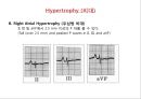 [Dankook Sports Medicine] 07. Abnormalities of the EKG.ppt 22페이지